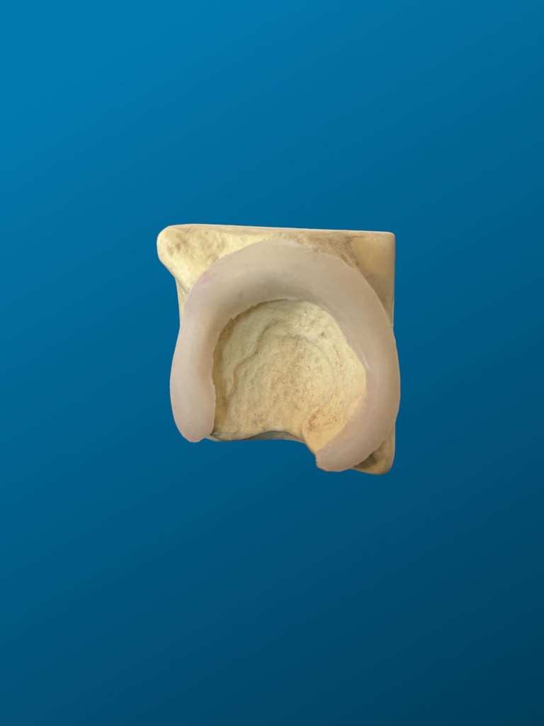 [1130] Acetabulo en bloque con labrum