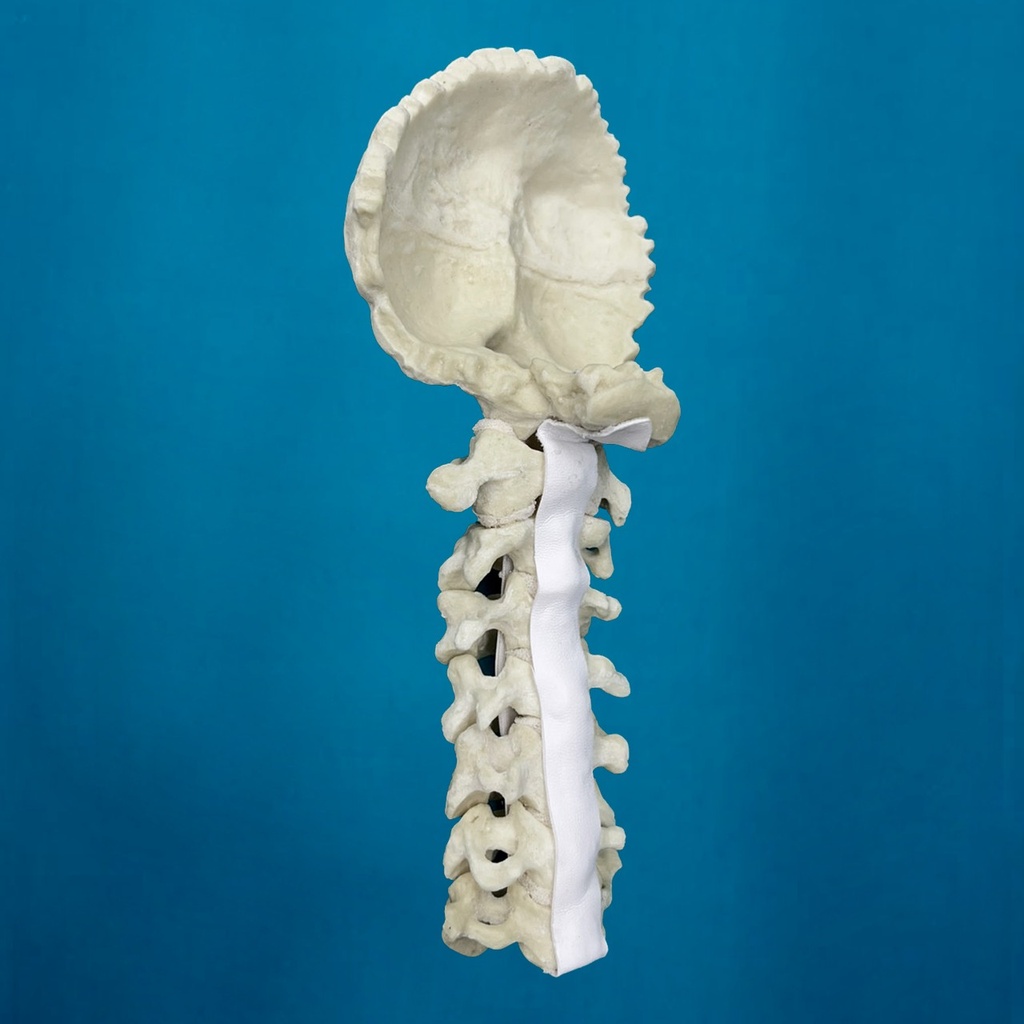 [1007] Cervical C1 a C7 con occipital