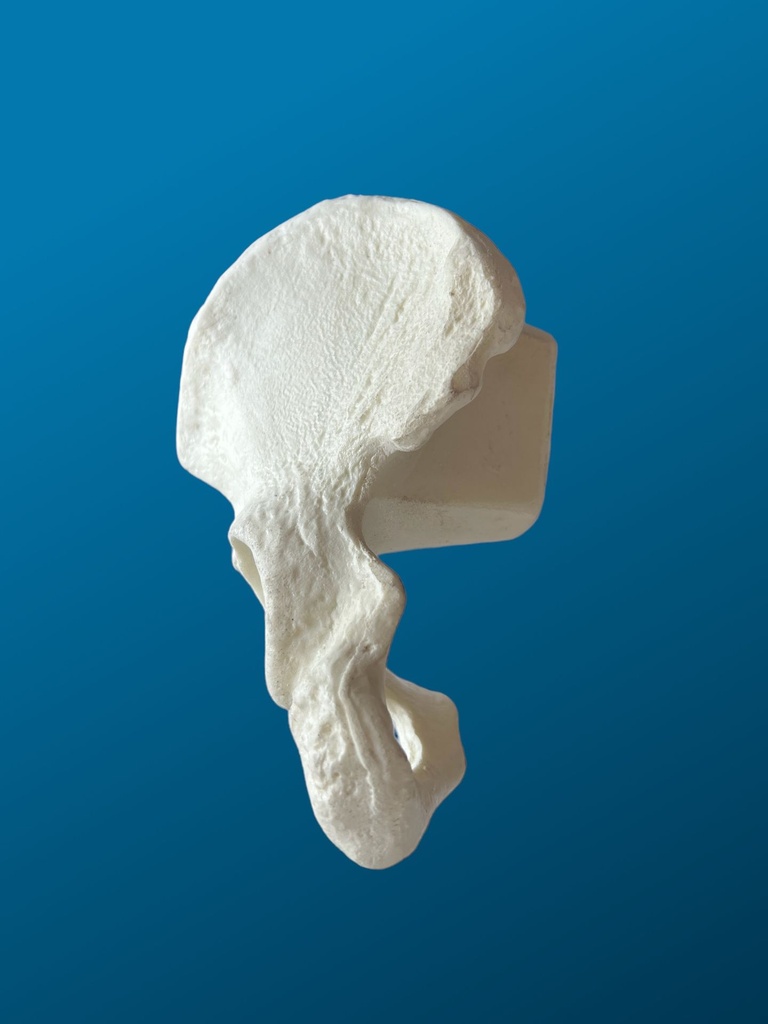[1108] Hemipelvis con acetábulo de 54 mm, izquierda, con accesorio de tornillo de banco.