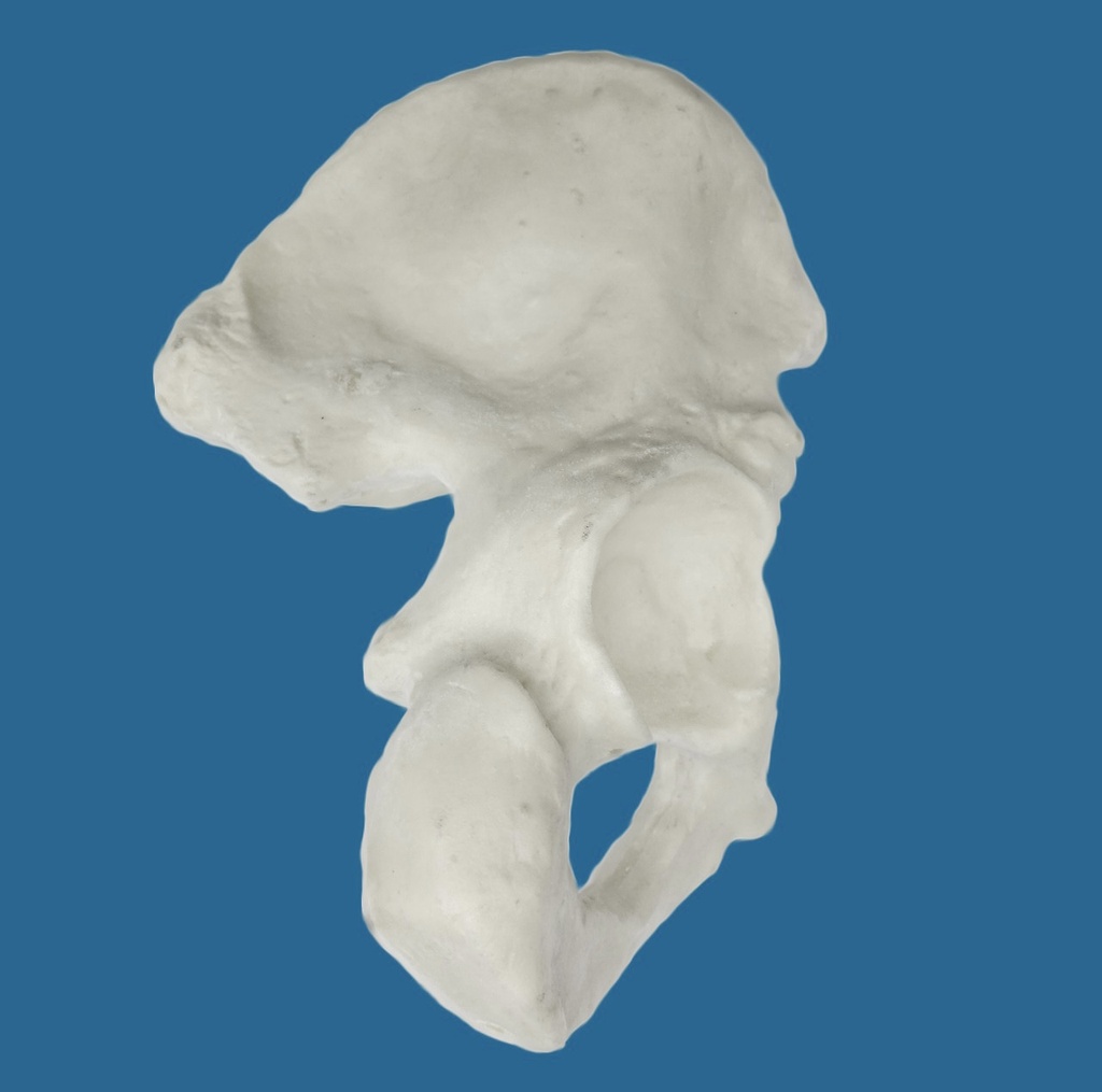 [1110-10] Hemipelvis con acetábulo de 57 mm, derecho