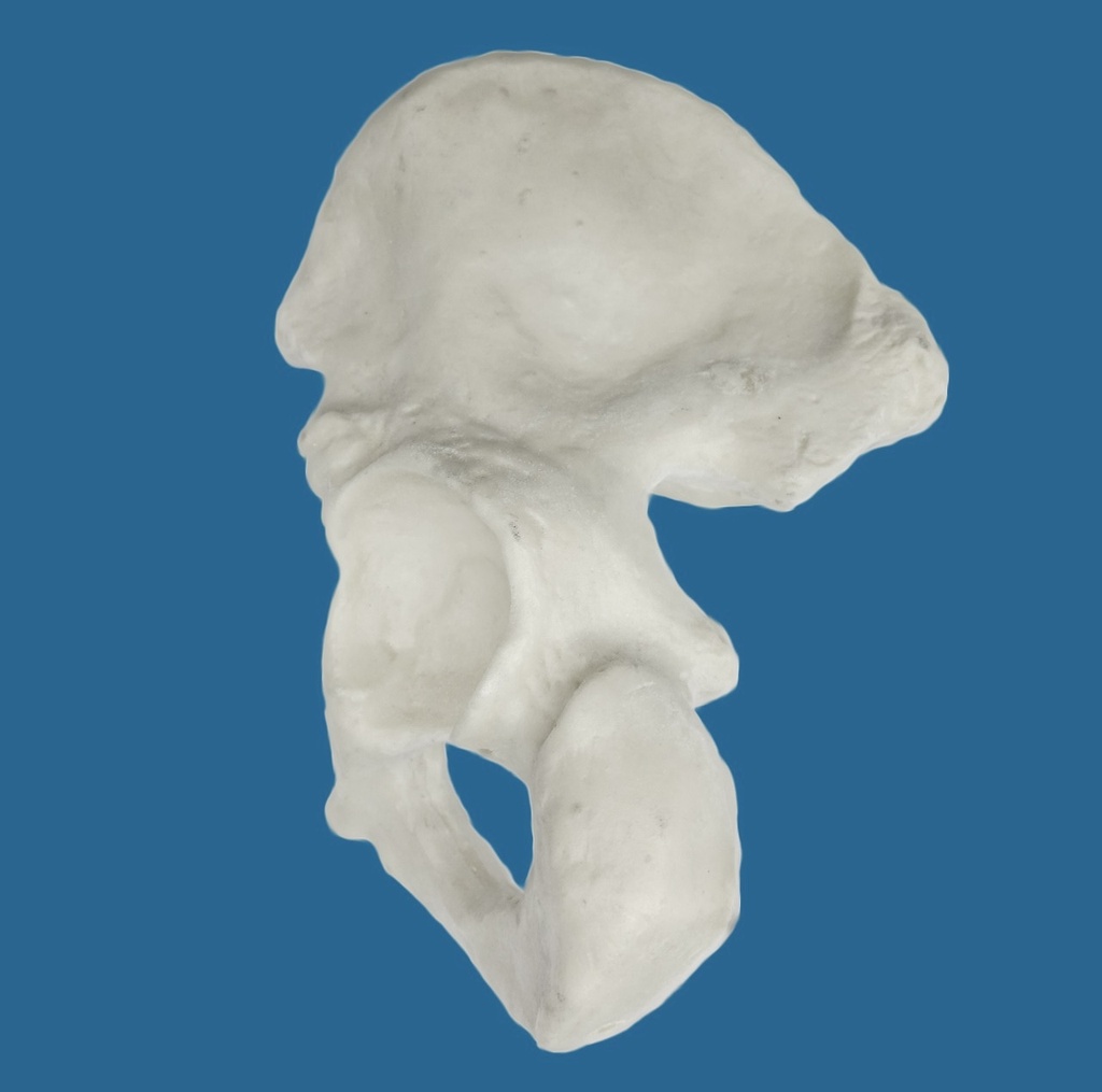 [1110] Hemipelvis con acetábulo de 57 mm, izquierdo