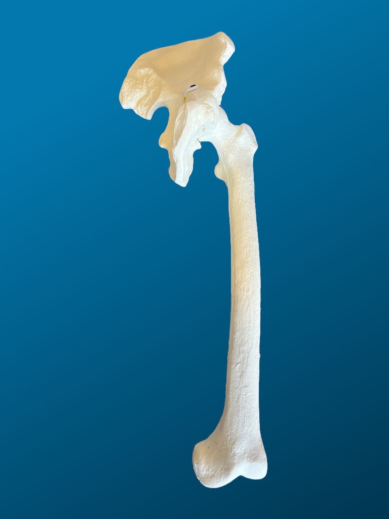 [1155] Hemipelvis con femur completo.