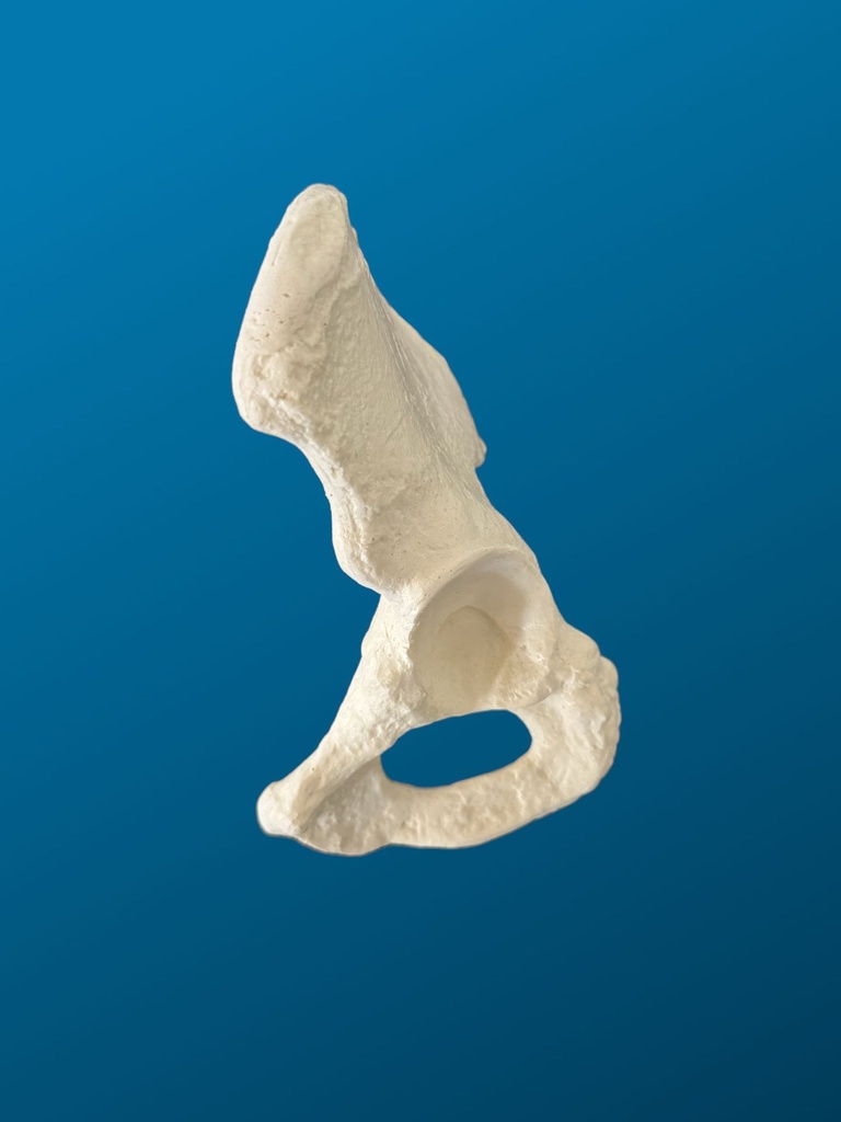 [1207] Hemipelvis pediatrica displásica, espuma solida, izquierda