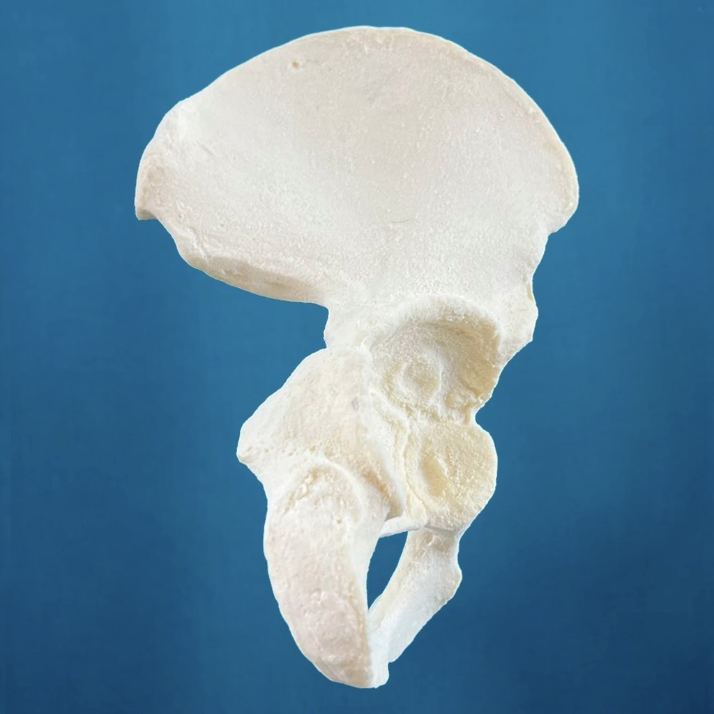 [1114-10] Hemipelvis pediátrica con acetábulo de 38 mm, derecha