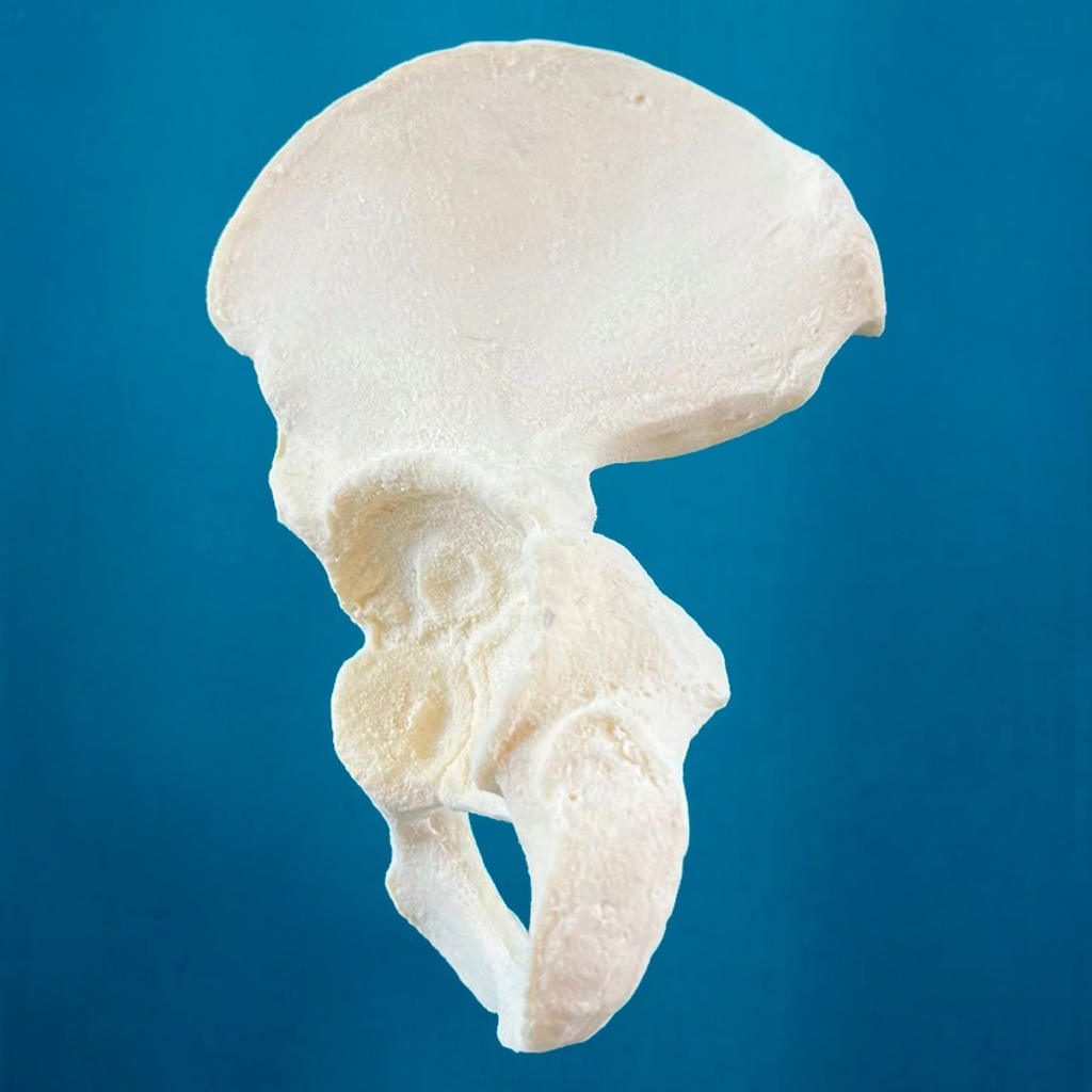 [1114] Hemipelvis pediátrica con acetábulo de 38 mm, izquierda