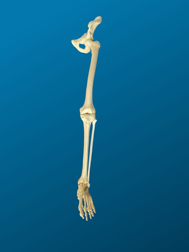 [1154] Hemipelvis, rodilla y tobillo articulados.