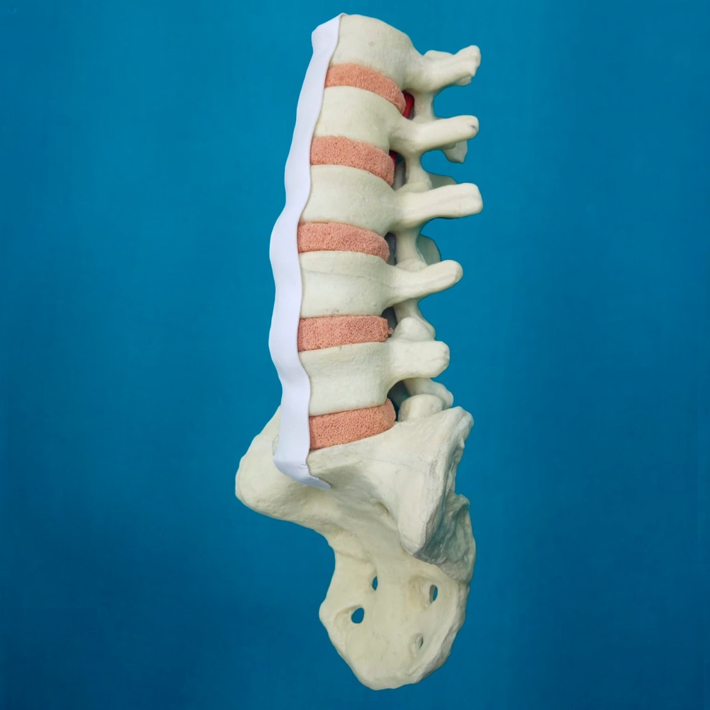 [1010] Lumbar L1 a Sacro