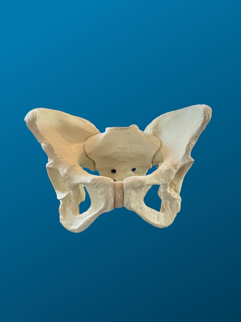 [1122] Pelvis Displasica