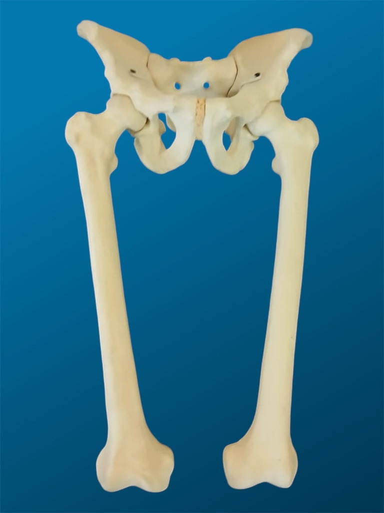 [1129] Pelvis completa c/ labrum, ambos femur c/deformidad y articulados