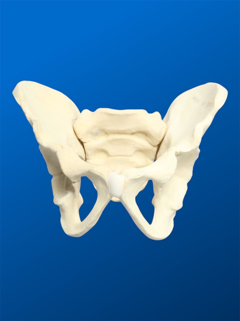 [1113] Pelvis completa pediátrica con isquion y pubis definidos. Acetábulo de 38 mm