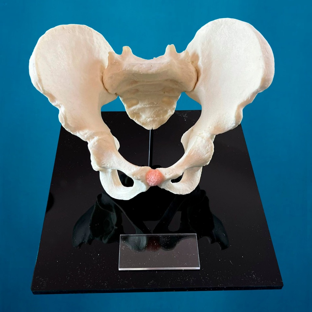 [1603] Pelvis pediátrica montada en base de acrílico. (Incluye grabado en láser personalizado.)