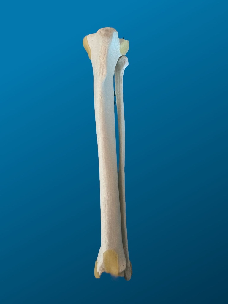 [1753] TIBIA Y PERONÉ, CANINO, ESPUMA SOLIDA