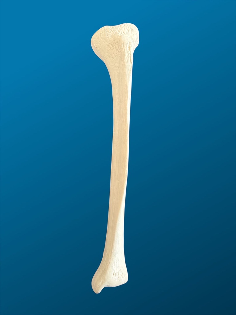 [1219] Tibia con deformidad en varo