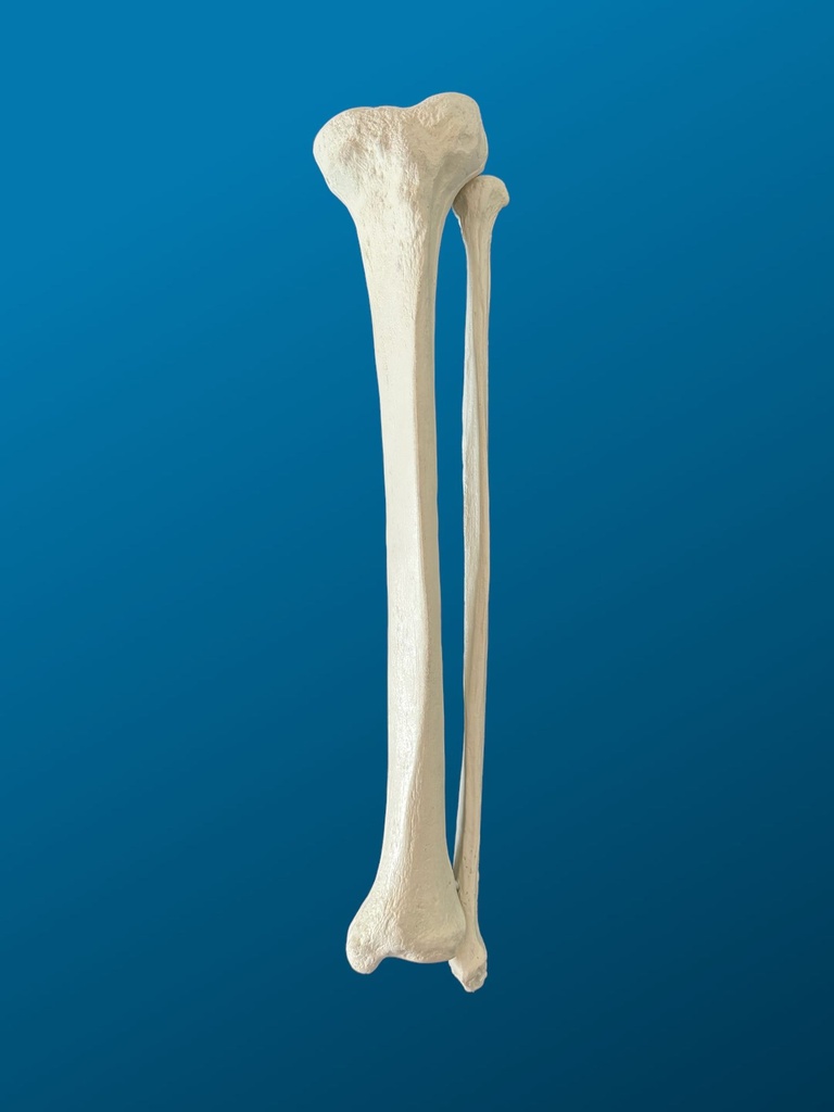 [1128] Tibia con peroné, con esponjoso, espuma solida, izquierda