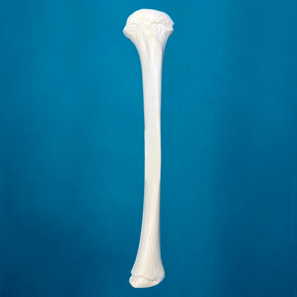 [1107] Tibia pediátrica, izquierda
