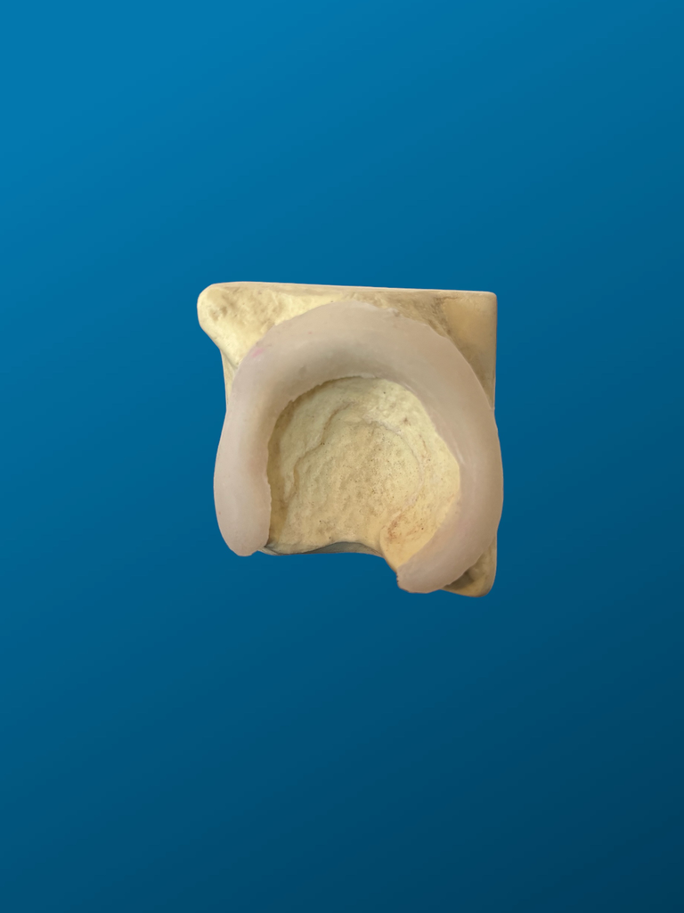 Acetabulo en bloque con labrum