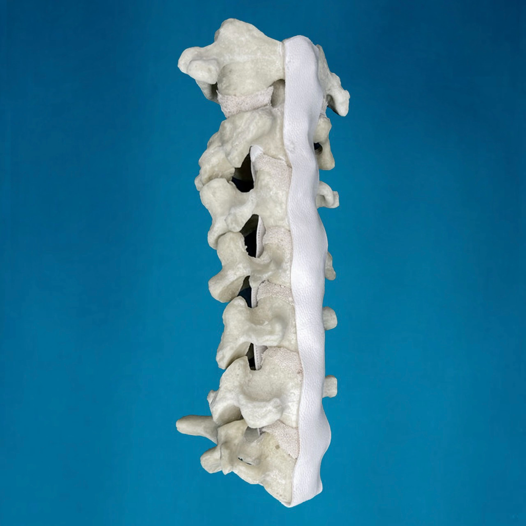 [1008] Cervical C1 a C7