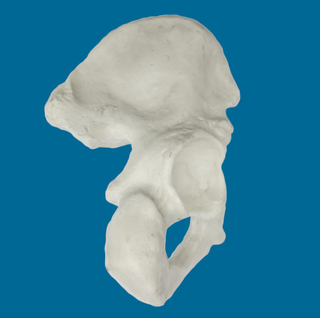 [1110-10] Hemipelvis con acetábulo de 57 mm, derecho