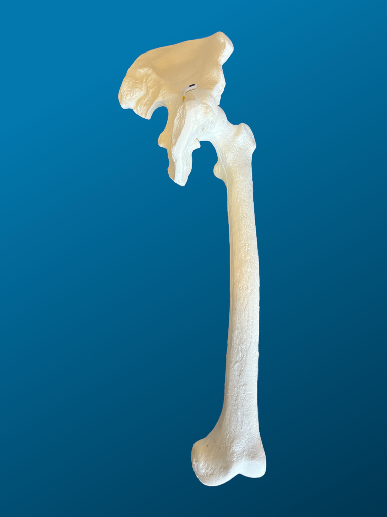 [1155] Hemipelvis con femur completo.