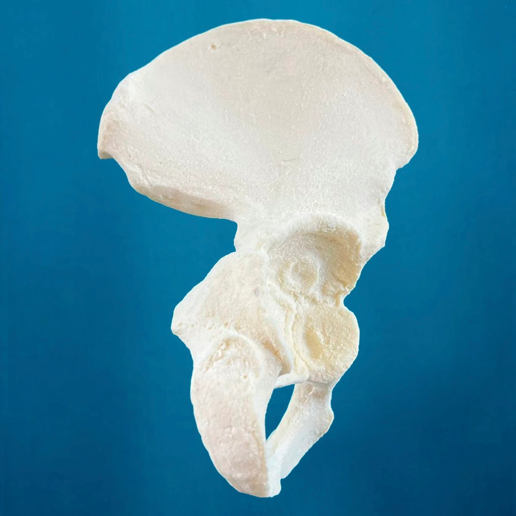 [1114-10] Hemipelvis pediátrica con acetábulo de 38 mm, derecha