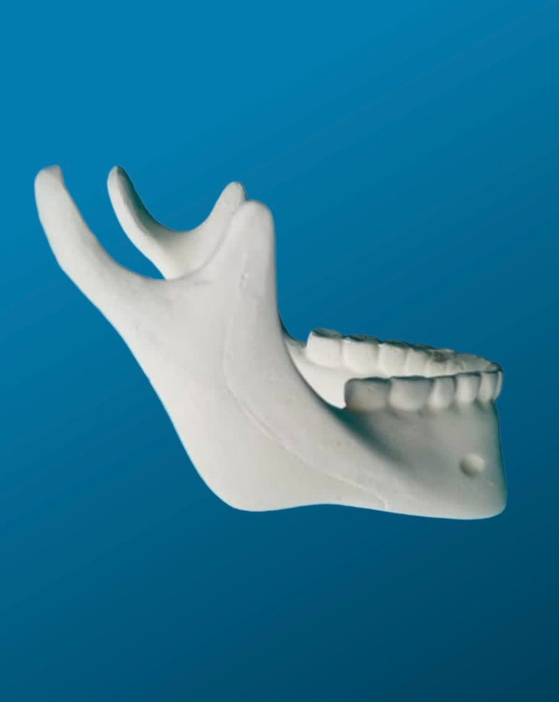 Mandíbula con dientes
