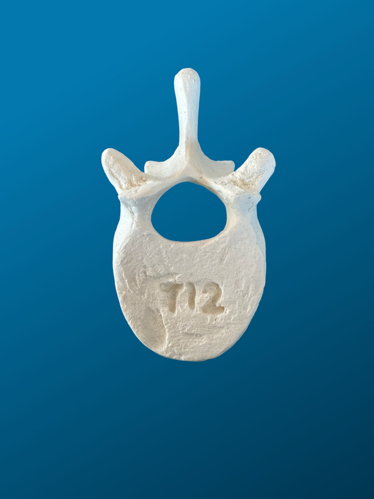 T12