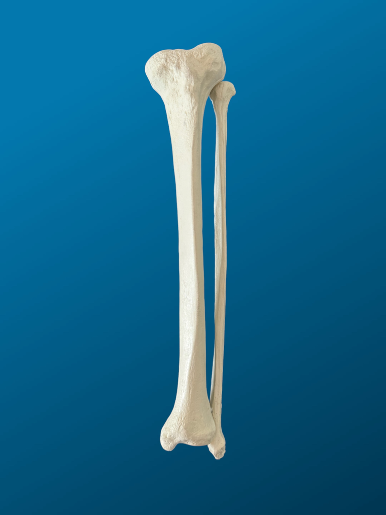 [1128] Tibia con peroné, con esponjoso, espuma solida, izquierda