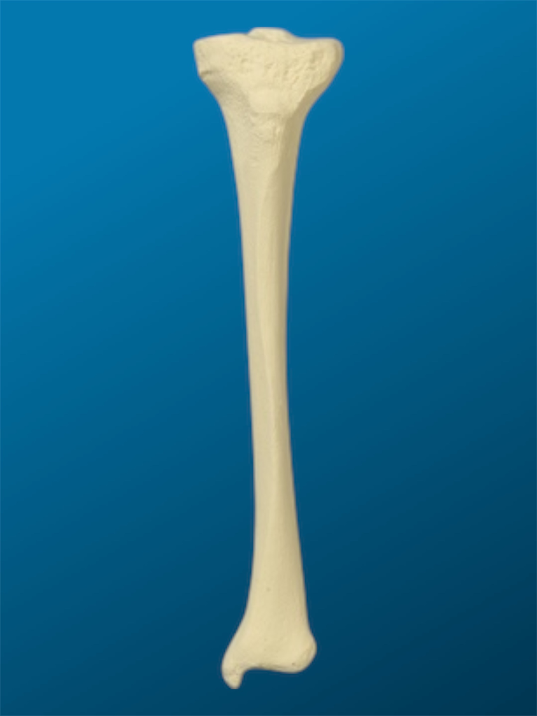 [1206] Tibia con una longitud total de 30 cm, con canal y esponjoso, izquierda