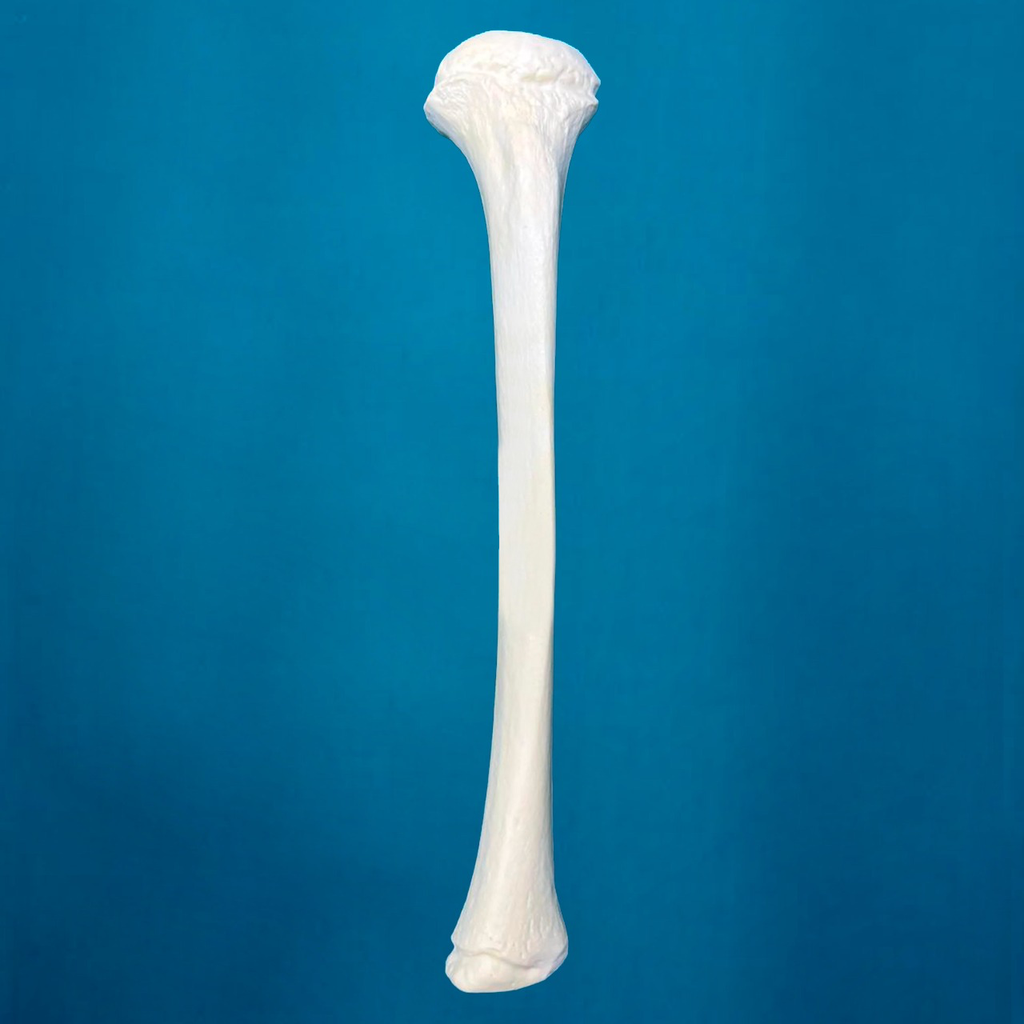 Tibia pediátrica, izquierda